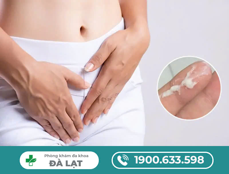 Khí Hư Trắng Đục Kèm Ngứa: Nguyên Nhân và Cách Điều Trị